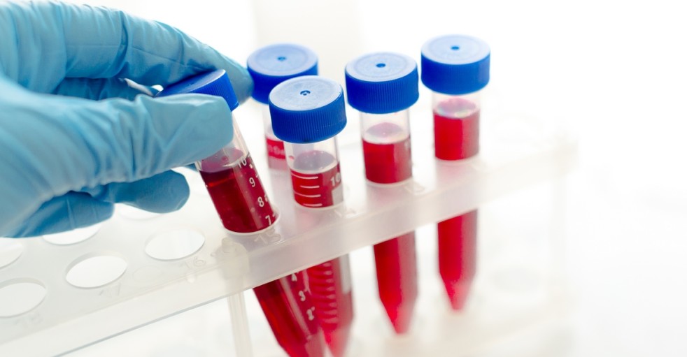 inzulinrezisztencia lelki okai